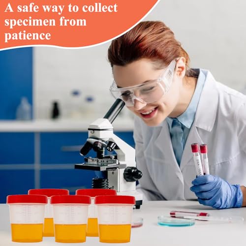 15Pcs Leak Proof Specimen Cups with Lids, 4oz Disposable Urine Cups | Specimen Container with Screw on Lid,Sample Collection Kit for Safe Urine Pee Sample Analysis Testing - style: Red-15PCS