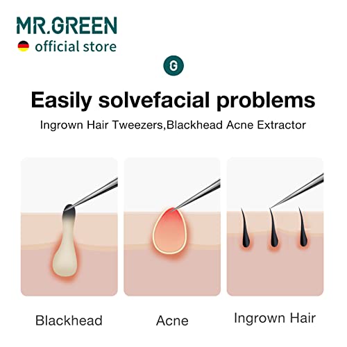 MR.GREEN Ingrown Hair Tweezers Needle Nose Pointed Tips Tweezers For Eyebrows Splinters Blackhead Removal Acne Clip Extractor (Long) - size: Long
