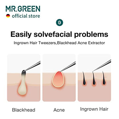 MR.GREEN Ingrown Hair Tweezers Needle Nose Pointed Tips Tweezers For Eyebrows Splinters Blackhead Removal Acne Clip Extractor (Long) - size: Long