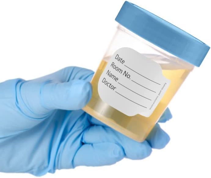 Vakly 4 oz Specimen Cups with Lids, Leak-Proof, 20 Pack | Clear polypropylene, non-sterile, screw-top lids, graduated markings, urine, stool & lab specimen collection