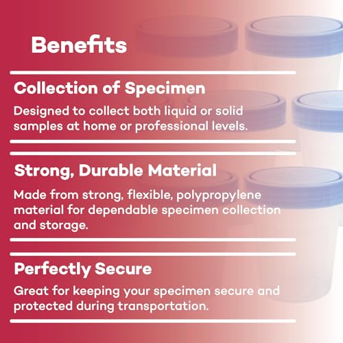 Dealmed Urine Specimen Cups with Lids - Non-Sterile, 4 oz, 500 Count | Polypropylene Construction, Screw-On Leak Resistant Cap, Single Use, For Clinics And Labs, Liquid Or Solid Samples