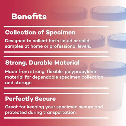 Dealmed Urine Specimen Cups with Lids - Non-Sterile, 4 oz, 500 Count | Polypropylene Construction, Screw-On Leak Resistant Cap, Single Use, For Clinics And Labs, Liquid Or Solid Samples